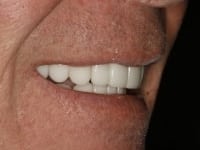 Konig Center for Cosmetic & Comprehensive Dentistry smile photos